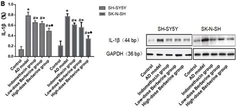 Expression of IL 1β mRNA and protein A RT PCR analysis of the mRNA