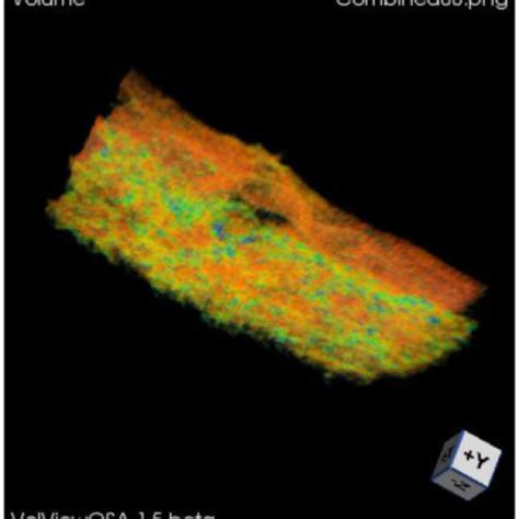 D Ps Oct Dataset Of The Retina And Rpe Layer Of An Amd Patient With