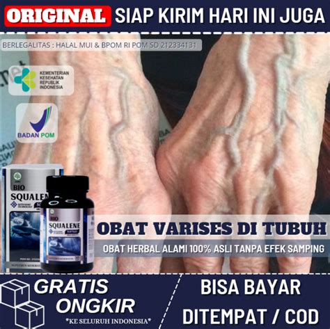 Obat Herbal Varises Di Tubuh 100 Alami Obat Varises Di Tangan Paha