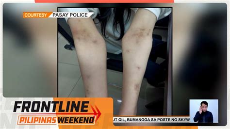 Koreanang Hinalay Umano Ng Kapwa Korean National Nasagip Sa Pasay