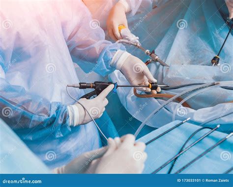 Process Of Gynecological Surgery Operation Using Laparoscopic Equipment