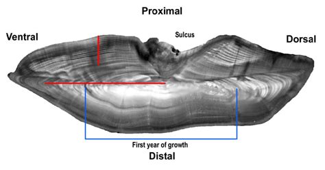 Hoki Otolith Image Bandw Of A Baked Transverse Cross Section Under