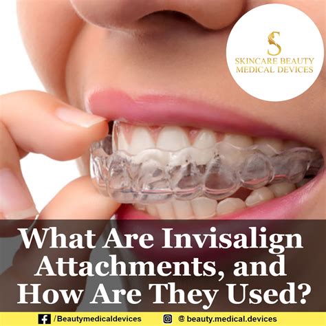 What Are Invisalign Attachments And How Are They Used