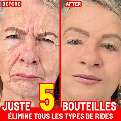 S Rum Facial Anti Ge Et Anti D Formable Efficace Limine Les D