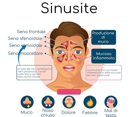 Sinusite Sintomi Rimedi E Cura