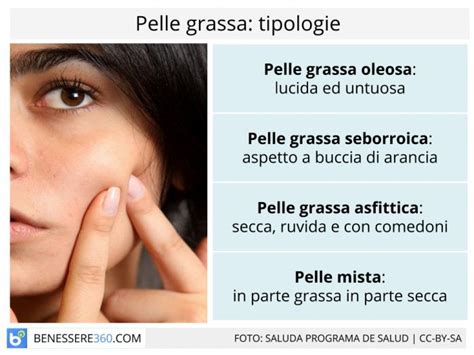 Pelle Grassa Cause Creme E Prodotti Per La Cura Del Viso Oleoso