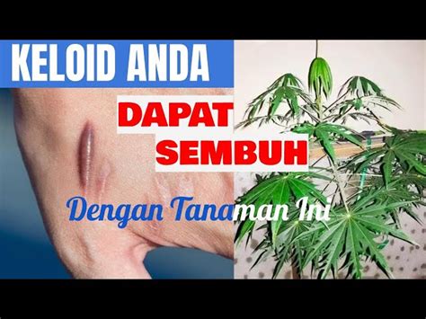 Temukan Rahasia Tanaman Yodium Yang Jarang Diketahui Solider