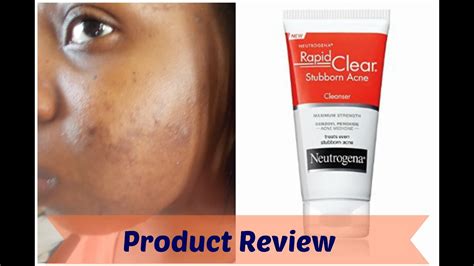 Quick Review Neutrogena Rapid Clear Stubborn Acne Cleanser Youtube