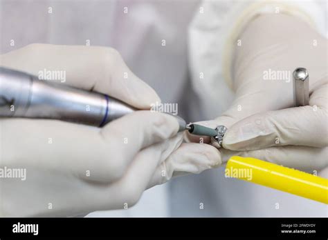 Dental Crown Fitting Hi Res Stock Photography And Images Alamy