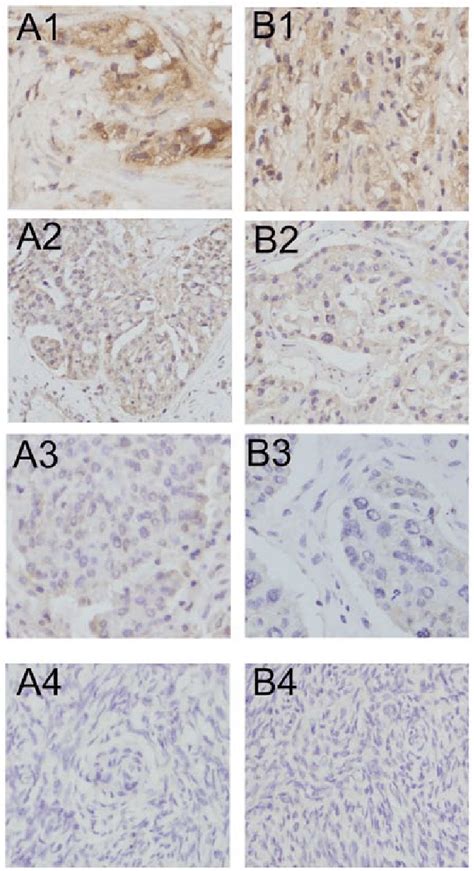 Immunohistochemical Staining Of Lewisy Antigen And Muc1 In Various Download Scientific