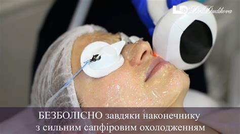 Фотоомоложение кожи Киев всего за 2 процедуры - Фотоомолодження шкіри ...