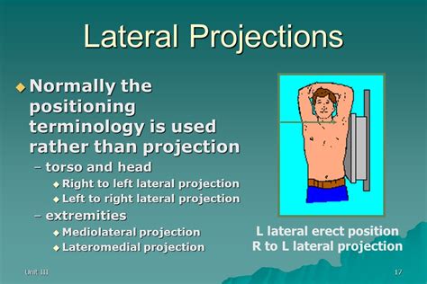 Introduction To Radiography Ppt Video Online Download