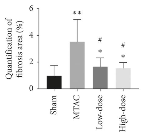 Yqwy Alleviated Mtac Induced Cardiac Fibrosis A Representative