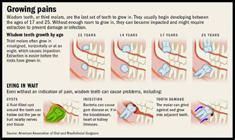 Wisdom Tooth Growing Pains Teeth Whitening That Works Teeth Whitening