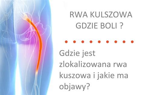 Rwa Kulszowa Leczenie Domowe Sposob W Poradnik