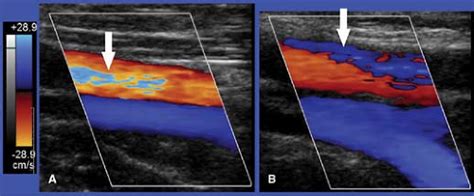 Vascular Ultrasound Radiology Key