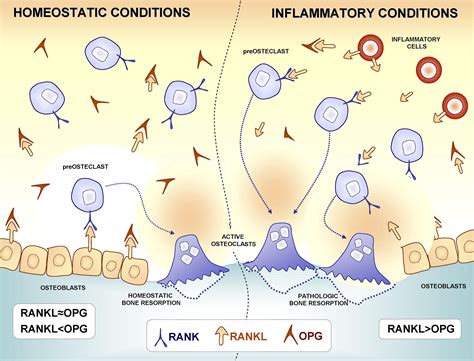 Differential Patterns Of Receptor Activator Of Nuclear Factor Kappa B