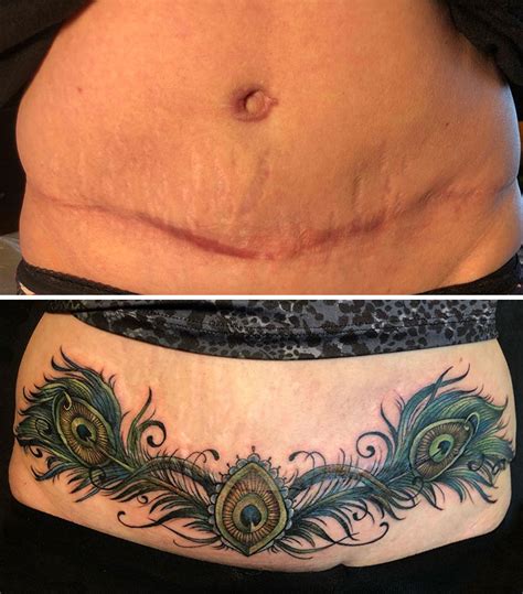 Tattoos To Cover C Section Scars Adesuwaaaliya