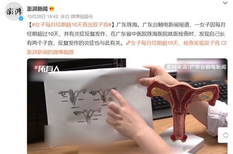 雙陰道雙子宮同時妊娠！罕見且危險 壹讀