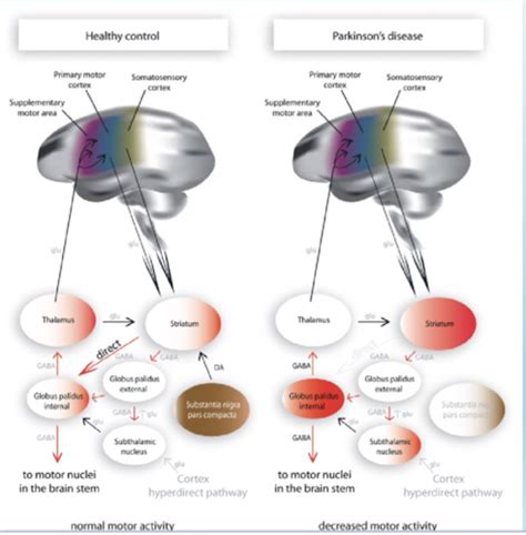Parkinsons Patho Pharmacology Flashcards Quizlet