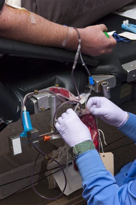 A Doação De Sangue Doa a Transfusão Fornecedora Médica Foto de Stock