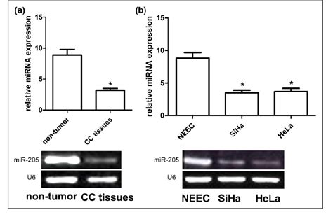 Figure From Mir Serves As A Prognostic Factor And Suppresses