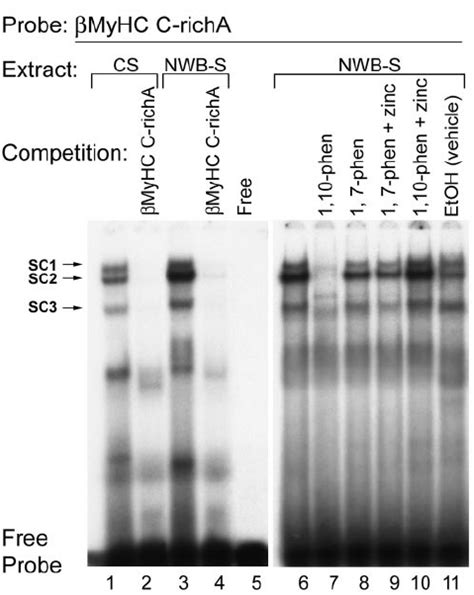 Emsa Assessment Of Sequence Specific Protein Dna Interaction At The