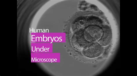 Human Embryo Under Microscope This Is How Life Begins At Conception Youtube