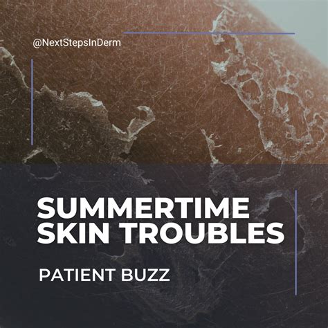 Patient Buzz Series Summertime Skin Troubles Next Steps In Dermatology