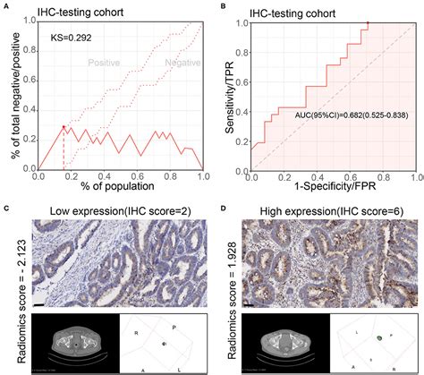 Frontiers A Novel Model Based On CXCL8 Derived Radiomics For