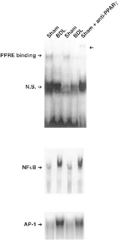 Figure 3 From Peroxisome Proliferator Activated Receptors And Hepatic