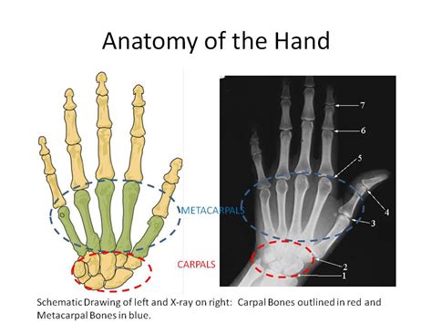 Thumb Pain: CMC Joint Arthritis | Centeno-Schultz Clinic - Denver, CO