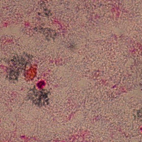 Fontana Masson Staining Left And B Peptide Staining Right Of