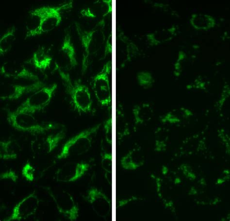 Fluorescent Mitochondria U Os Cell Line Innoprot Stable Cell Lines