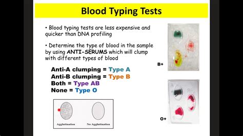 Blood Basics Notes Forensics YouTube