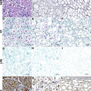 Photomicrographs Of Longitudinal Sections Of Decellularized And Control