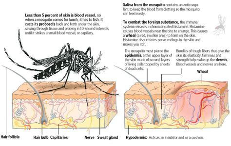 WHY MOSQUITO BITE ITCHES General Knowledge