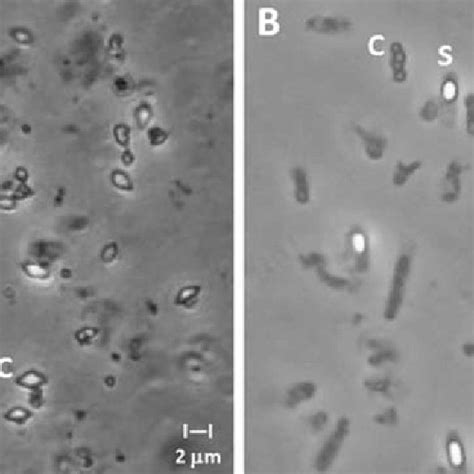 Cry Protein Sds Page Of Eight Bacillus Thuringiensis Strains Lane 1 Download Scientific