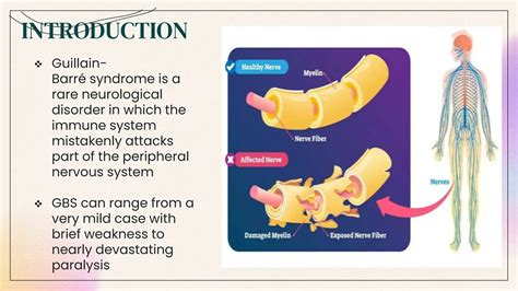 Guillain Barré syndrome PPT