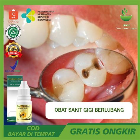 Jual Obat Mengatasi Sakit Gigi Berlubang Mengobati Gusi Bengkak