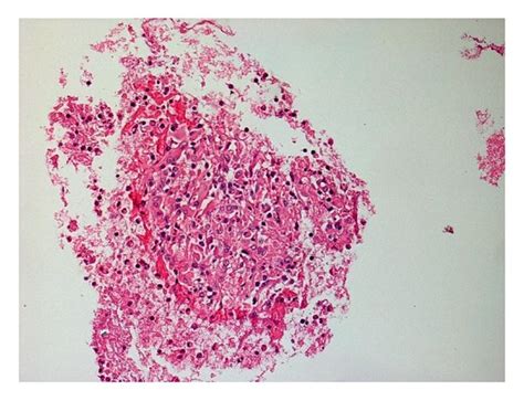 The Histological Finding Of Hematoxylin And Eosin Staining A Low