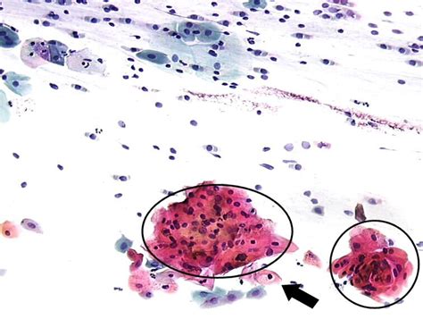 Cytopathology Of The Uterine Cervix Digital Atlas