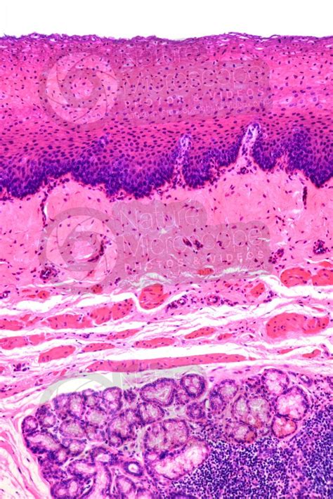 Man Esophagus Transverse Section X Esophagus Man Mammals