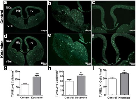 Ketamine Induces A Widespread Apoptosis In Fetal Brain Embryonic Day