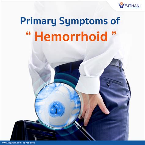 Early Hemorrhoids