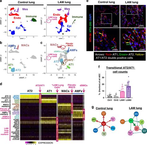 Single Cell Rna Seq Identifies Distinct Lam Lung Cells And Transitional