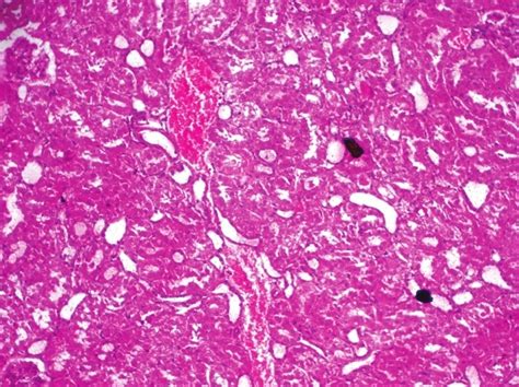 Photomicrograph Of Liver Showing Moderate Sinusoidal Congestion And