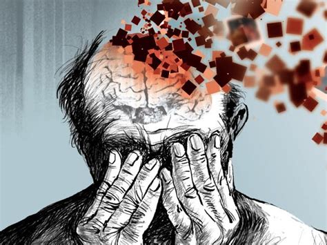 Memory Check Never Dismiss Dementia As An Old Age Problem Health