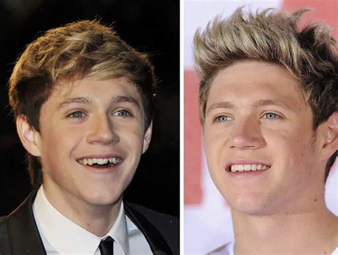 Celebrity Teeth Six Best Dental Before And After Makeovers