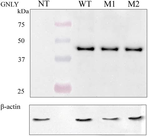 Western Blot Experiments From Cho Cells Transfected With Wt And Mutant